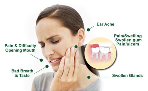 Wisdom Teeth Symptoms